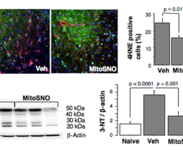 MitoSNO ischemia/reperfusion brain
